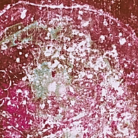 Anapoko